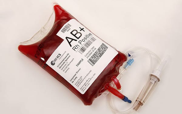 FDA launch study which could lift blood donation restrictions for gay and bi men