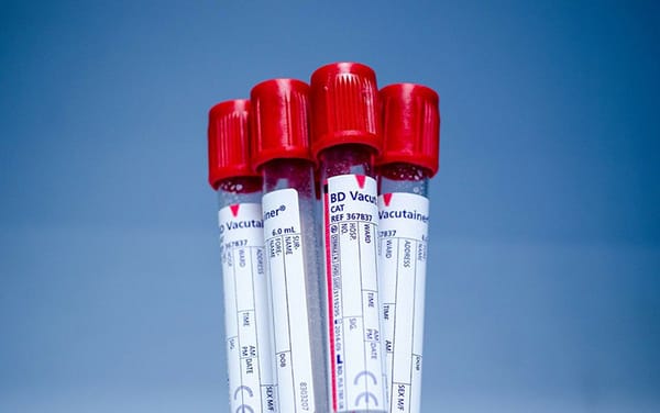 Germany to ease rules on gay and bisexual men donating blood