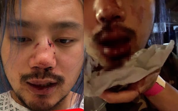 Cardiff student violently beaten in a suspected homophobic hate crime