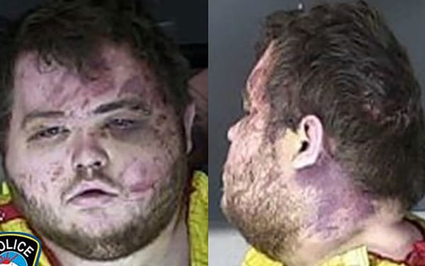 Colorado Springs: Club Q shooting suspect formally charged with 305 counts