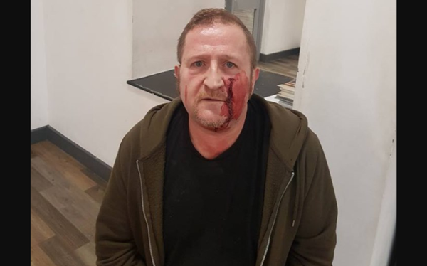 Ireland looking at new hate crime legislation after horrific homophobic attack