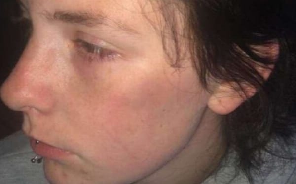 Dundee teen left “messed up by it all” after unprovoked homophobic attack