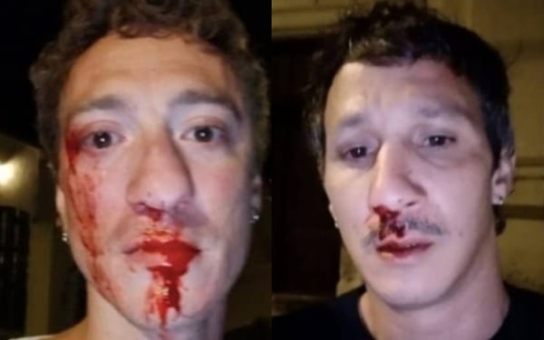 Gay couple brutally attacked as large crowd watched and “brought out the popcorn”