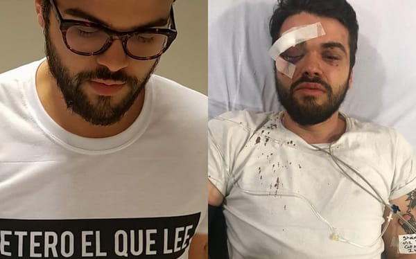 Gay rugby player suffers horrific injuries in homophobic attack