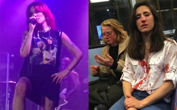Halsey slams ‘Straight Pride’ and wears t-shirt of assaulted lesbian couple during London gig
