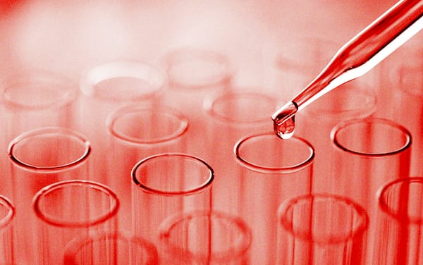 Scientists eliminate HIV from cells in lab, sparking new hopes for a cure