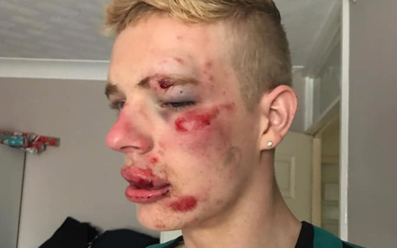 Arrest made in connection with an attack on gay man in Preston