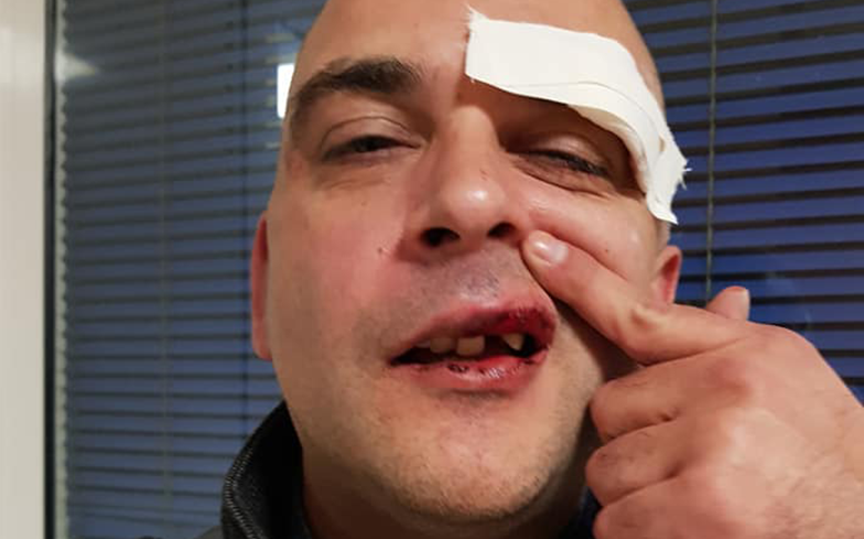 Man holding pink dog carrier beaten after attackers assumed he was gay