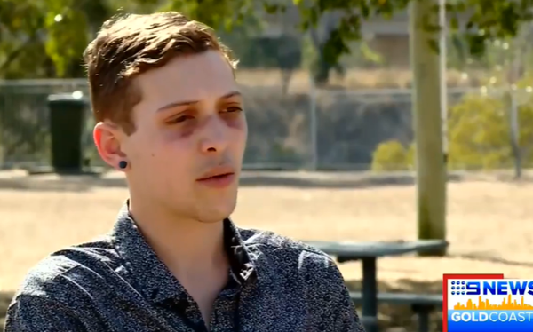 Gay man and brother attacked in a “bloodthirsty” homophobic attack in Australia