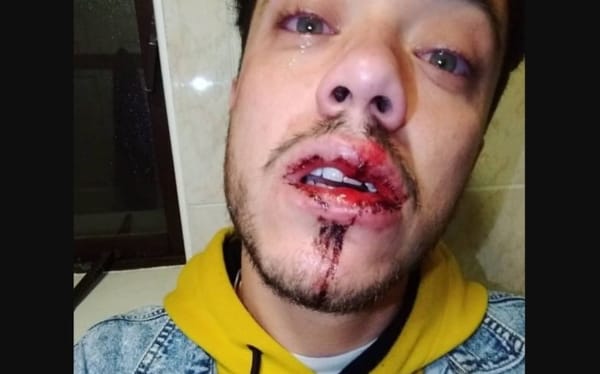 Dublin man attacked by a gang with steel bars after kissing his boyfriend