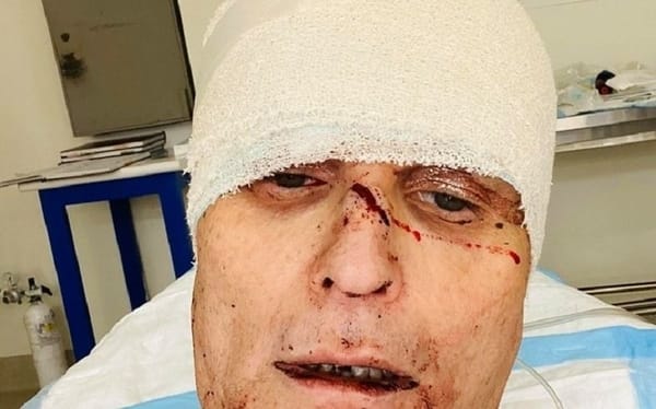 Gay man attacked with meat cleaver in horrific homophobic attack