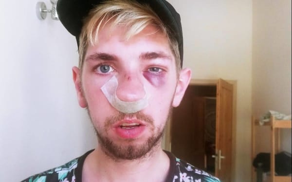 Gay Polish man horrifically beaten by drunken homophobic thugs