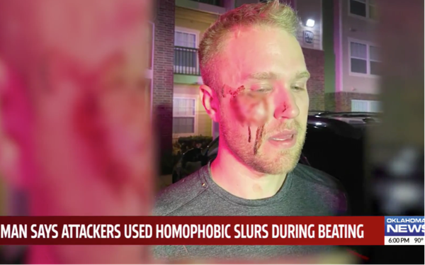 Real estate agent savagely beaten in suspected homophobic attack