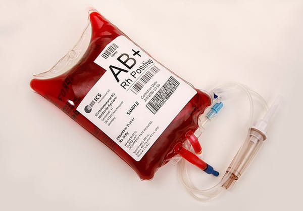 Malta’s Equality Minister says that blood donation laws could be further liberalised