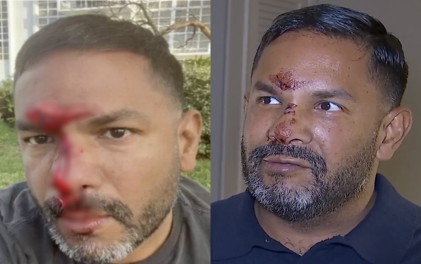 Florida man allegedly attacked “out of nowhere” for being gay