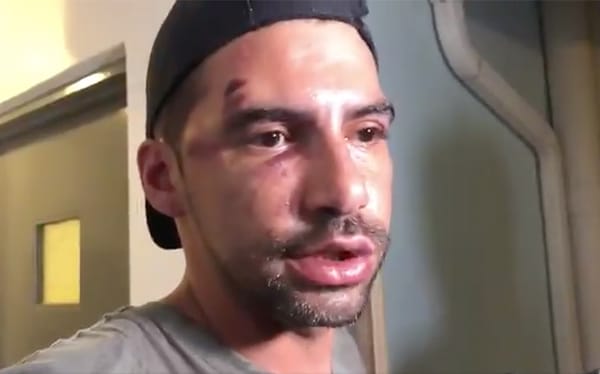 Gay couple brutally attacked by four men at Miami Beach Pride for holding hands
