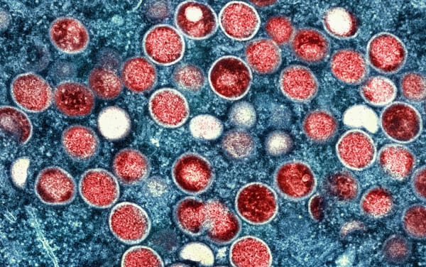 World Health Organization says mpox outbreak is no longer a “public health emergency of international concern”