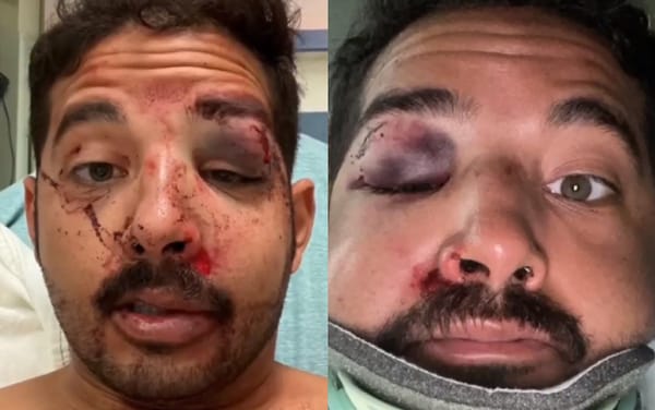 Gay man knocked unconscious and brutally beaten in homophobic hate crime