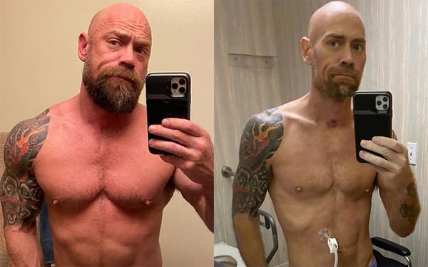 LGBTQ+ nurse shares shocking results from their fight with coronavirus