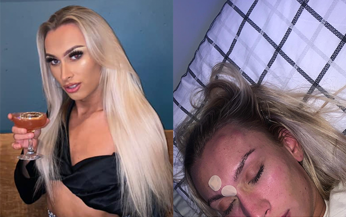 20-year-old trans woman attacked in public during a night out